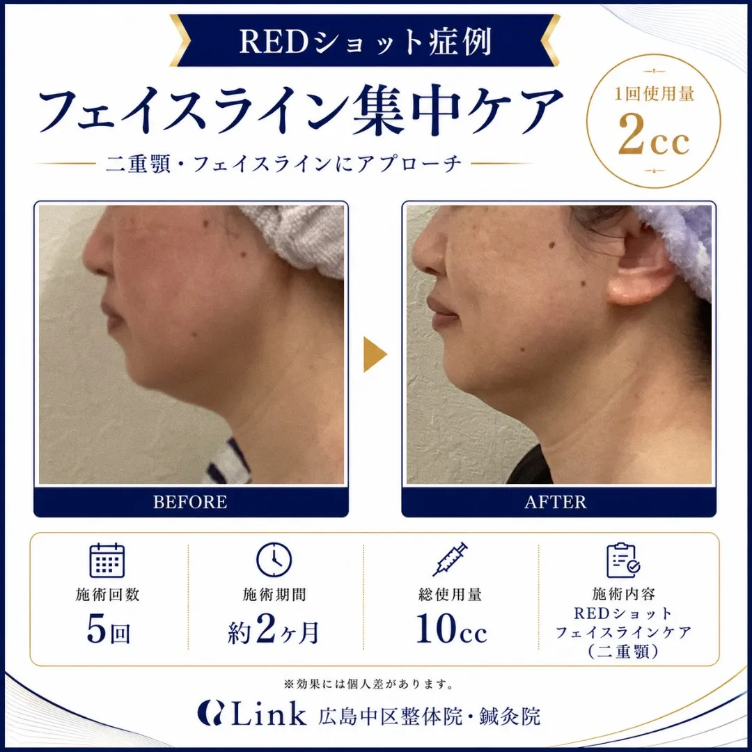 二重顎・フェイスラインのもたつきが気になる方へ😊