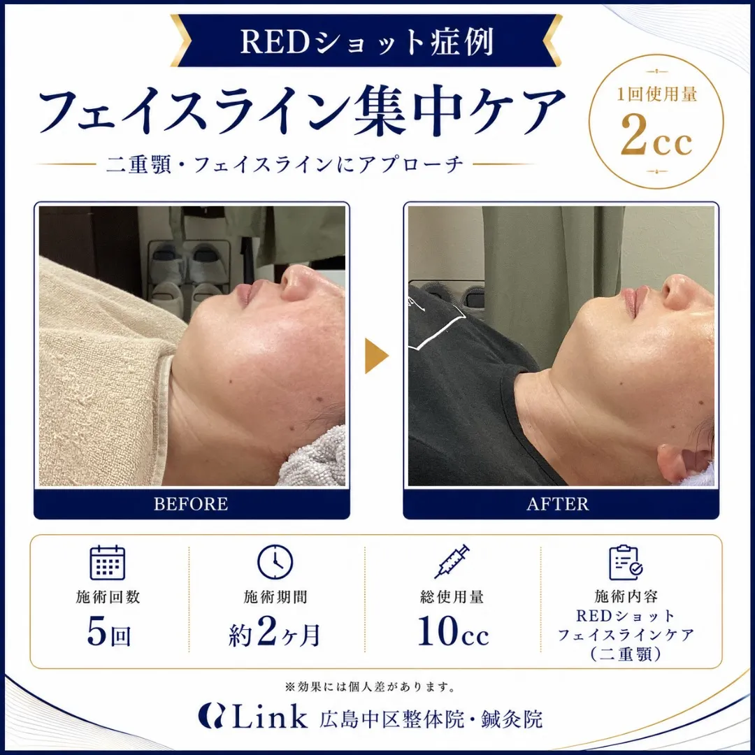 二重顎・フェイスラインのもたつきが気になる方へ😊