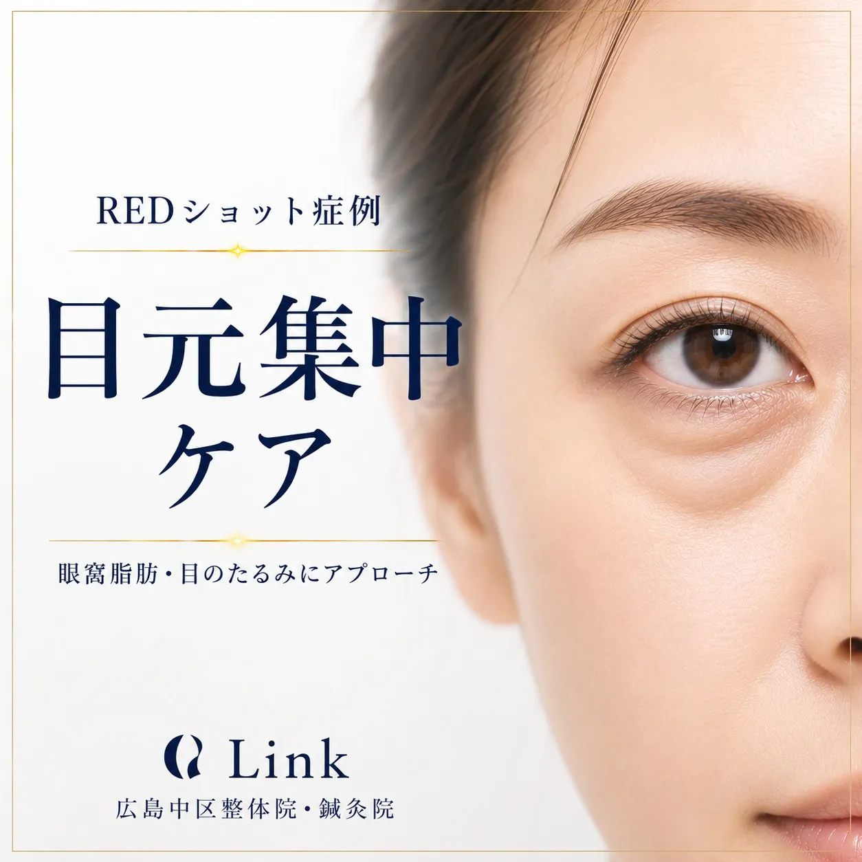 目元のお悩み解決します👀