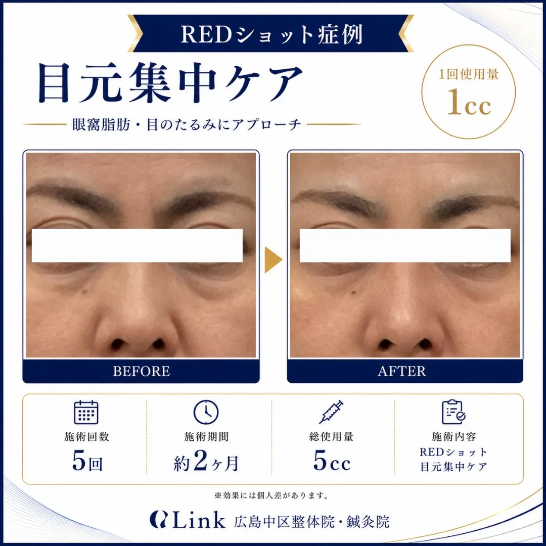 目元のお悩み解決します👀