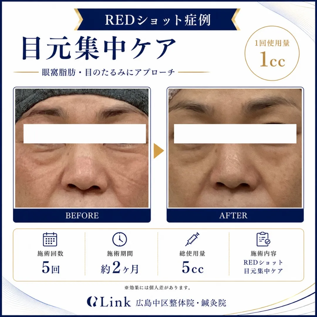 目元のお悩み解決します👀